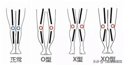 为什么跟着keep的瘦腿锻炼,也跟着拉伸了,屁股和大腿酸疼,但是每天拿尺子量腿却越来越粗?