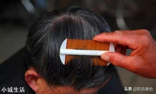 七八十年代人身上的虱子是怎么来的？