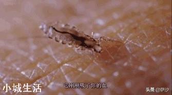 七八十年代人身上的虱子是怎么来的？