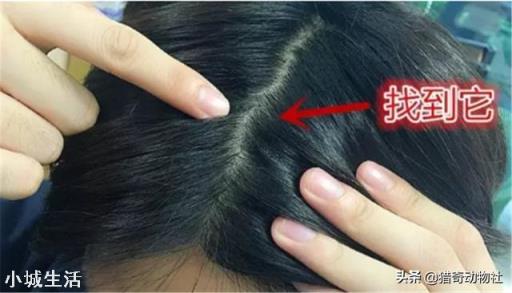 七八十年代人身上的虱子是怎么来的？