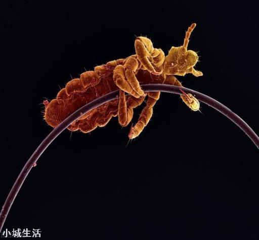 七八十年代人身上的虱子是怎么来的？
