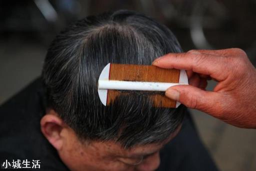 七八十年代人身上的虱子是怎么来的？
