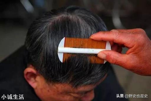 七八十年代人身上的虱子是怎么来的？