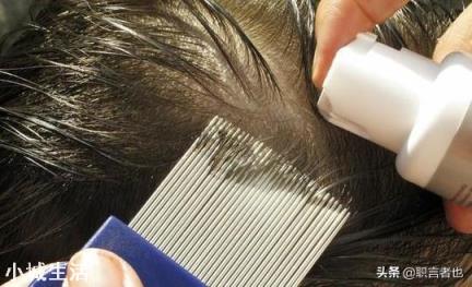 七八十年代人身上的虱子是怎么来的？