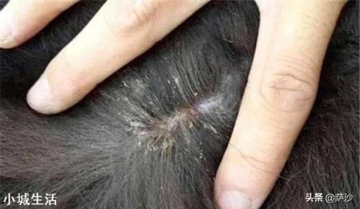 七八十年代人身上的虱子是怎么来的？