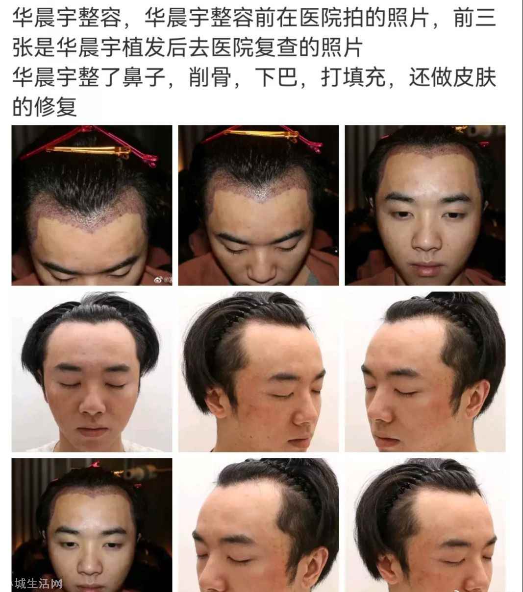 全面梳理华晨宇事件始末 爱豆事件来龙去脉