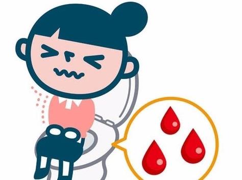 痔疮怎么治?膏效果怎么样?听用过的人怎么说!