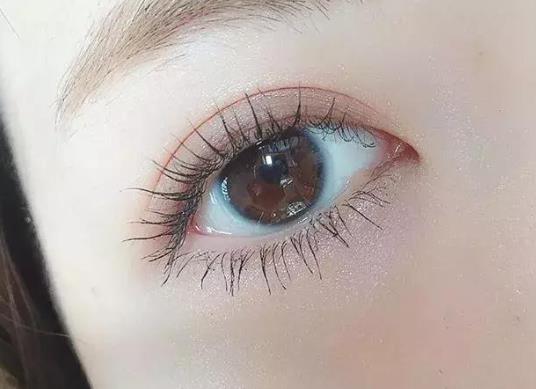 眼皮松弛能做双眼皮吗？全切双眼皮几年后会变自然？