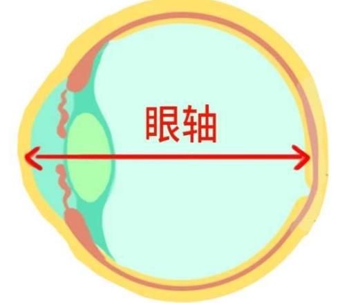 北京茗视光眼科：眼轴增长1mm孩子近视就增加300度吗？123123