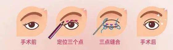 市场价 ?整容多少钱