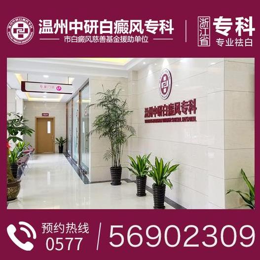 温州中研白癜风医院怎么样?白斑变淡是变好的趋势吗?