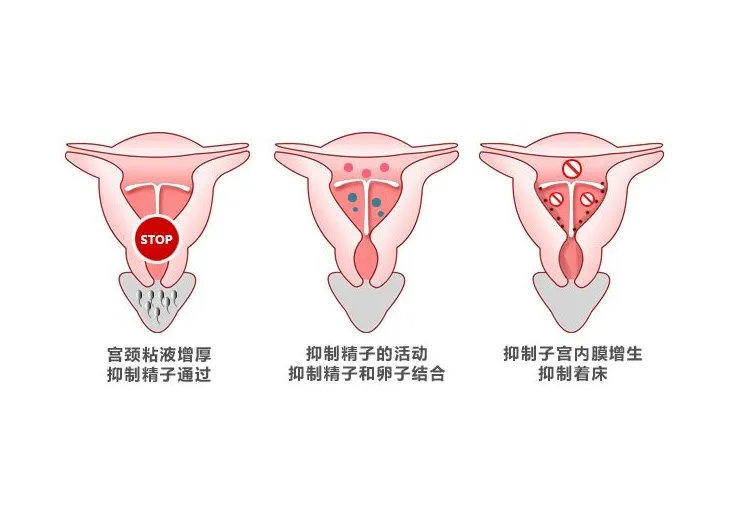 市场价 ?环多少钱