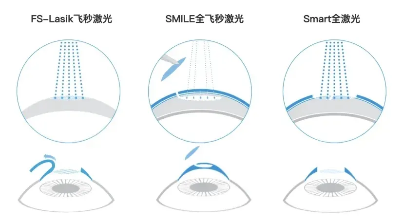 最新2021 做手術多少錢