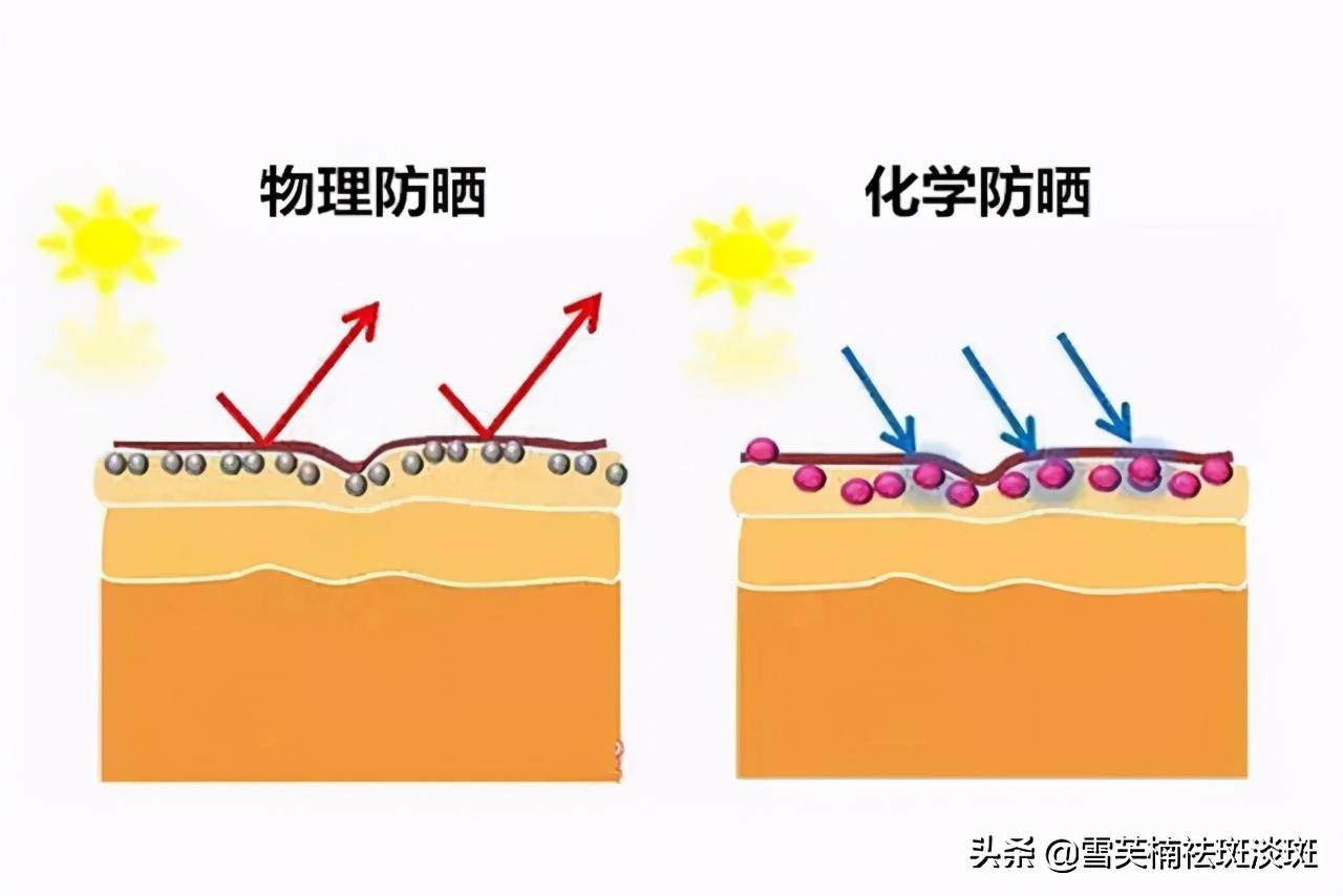 黄褐斑是怎么样形成的？ 黄褐斑是什么原因