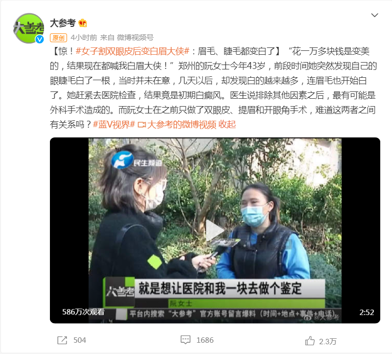 官方报价 割割双眼皮多少钱