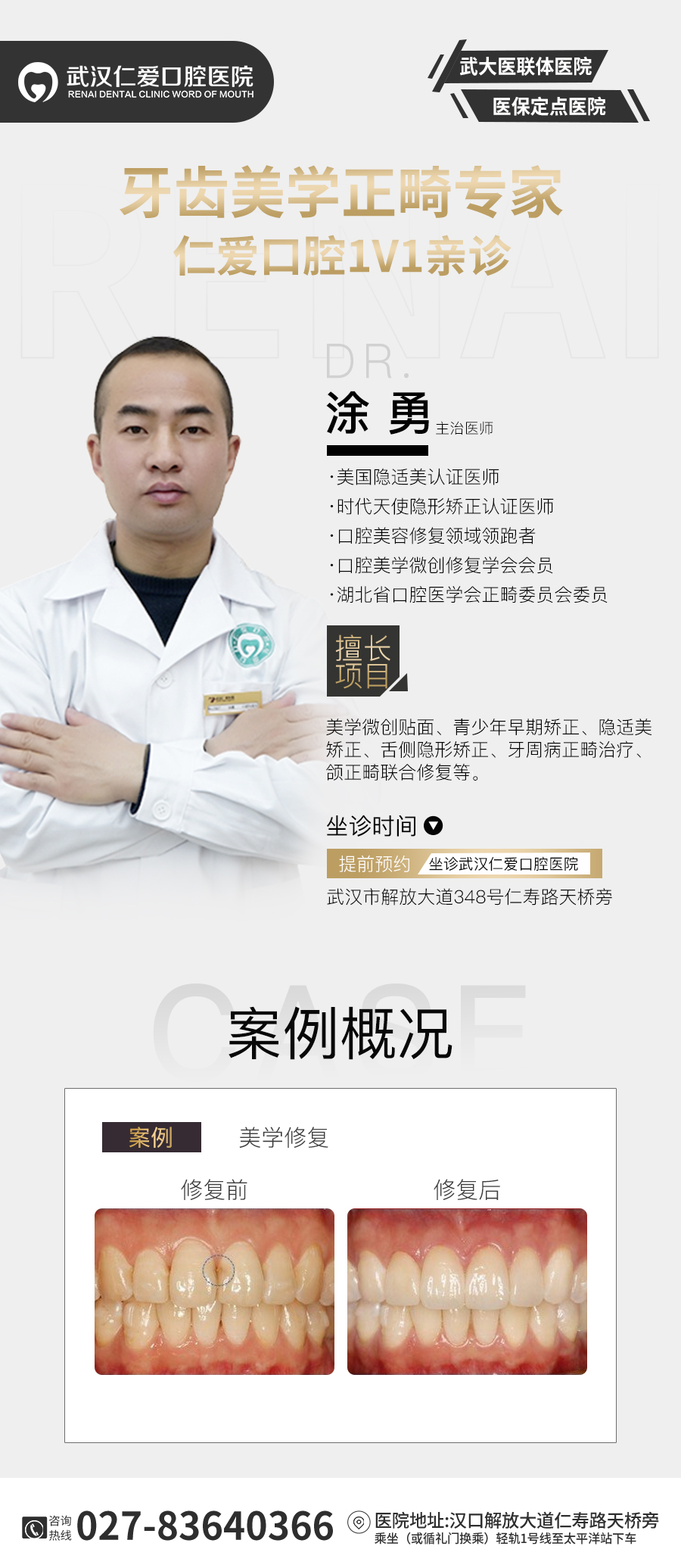 武漢仁愛口腔醫院「病例展示」——前牙貼面修復病例