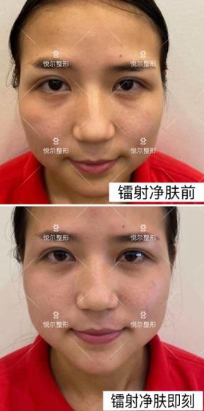 品質口碑 慈溪悅爾醫學美容醫院好不好？專業技術