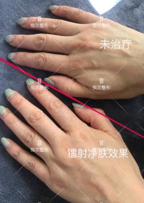 品質口碑 慈溪悅爾醫學美容醫院好不好？專業技術