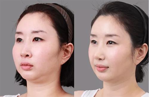 性感身材令人眼前一亮 獨腿美女酷愛健身