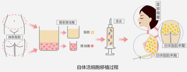 精致女人从这开始 军科整形刘月更院长靠不靠谱