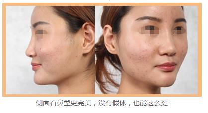 精致女人从这开始 军科整形刘月更院长靠不靠谱