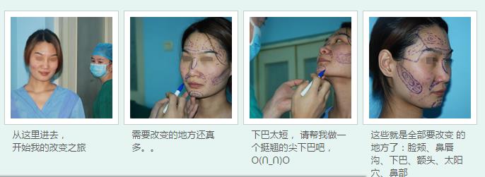 精致女人从这开始 军科整形刘月更院长靠不靠谱