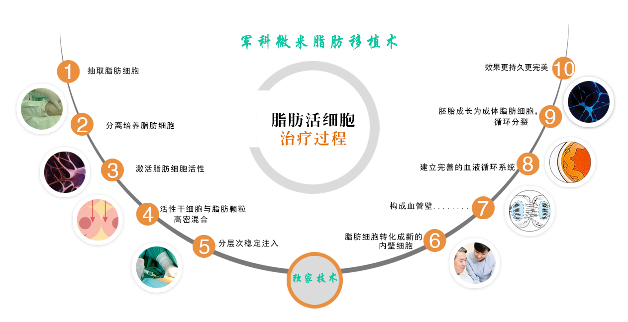 精致女人从这开始 军科整形刘月更院长靠不靠谱