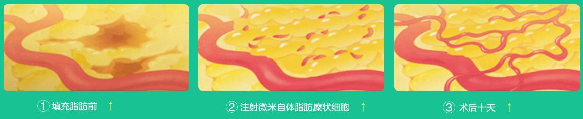 精致女人从这开始 军科整形刘月更院长靠不靠谱