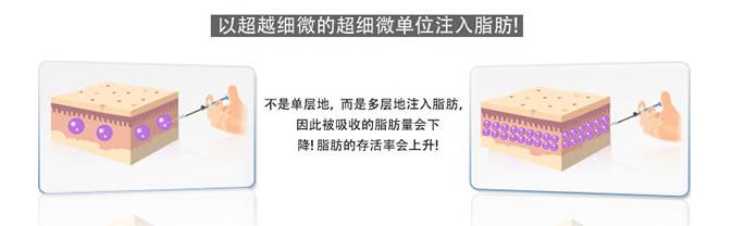 精致女人从这开始 军科整形刘月更院长靠不靠谱