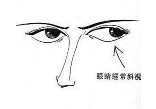 儿童斜视的原因 怎么纠正
