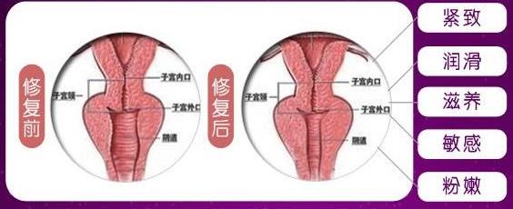 重庆哪家医院做3D生物束带比较好?