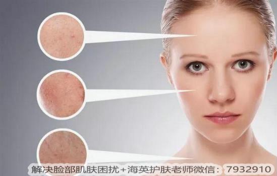 臉部皮膚過敏怎么辦？臉過敏的癥狀有哪些？