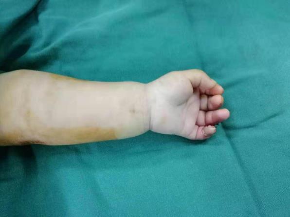 北京爱康医疗集团怎么样?骨科专家温馨提醒:家有幼儿,一定要小心这个“隐形”凶器