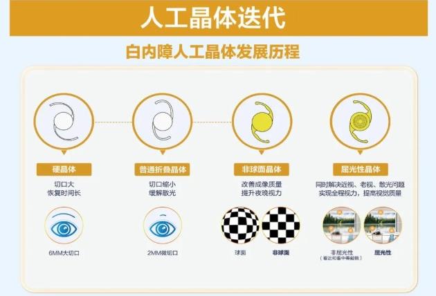 如何选择白内障人工晶体？上海眼科专家郭海科：不是越贵的就越好