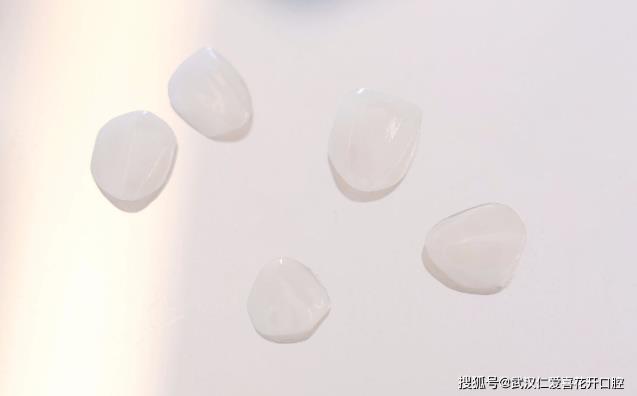 效果如何？ 武汉仁爱口腔医院贴面技术怎样