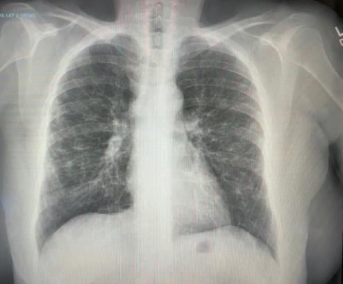 NMN类物质三期人体临床实验结果出炉，补充NAD+可加速新冠恢复速度