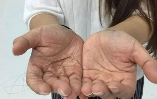 脱发的饮食调理 职业女性经常性掉发的原因
