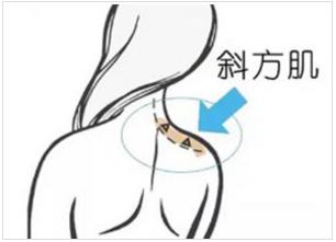 北京伊美尔爱康医院:瘦肩针的成分是什么?