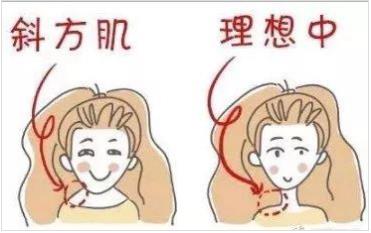 北京伊美尔爱康医院:瘦肩针的成分是什么?