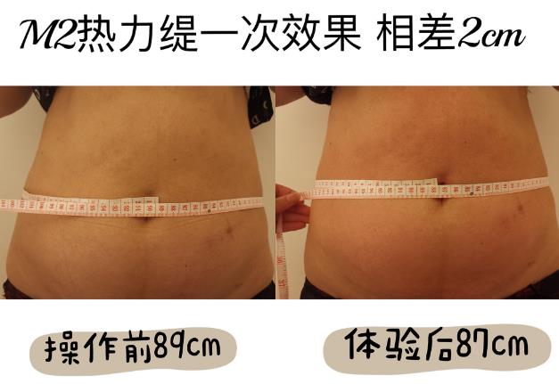 “热”辣秀出美丽 科技带来健康