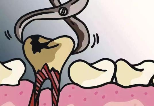 拔牙后冰敷是放在脸上还是牙齿上？拔牙后冰敷的注意事项