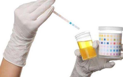 怎么预防尿酸高?尿酸高的人有哪些症状?