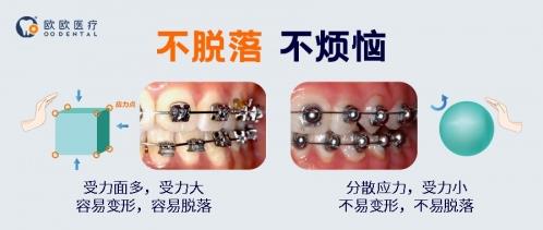 托槽掉了怎么办？球托舒适化矫正了解一下！