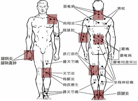 膏藥的正確貼法及貼膏藥禁忌 膏藥的使用方法