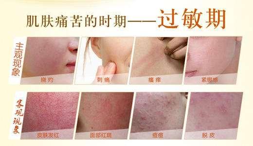 滿臉過敏癢怎么辦？臉過敏了幾天能好？