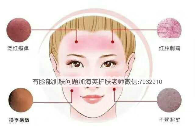 滿臉過敏癢怎么辦？臉過敏了幾天能好？