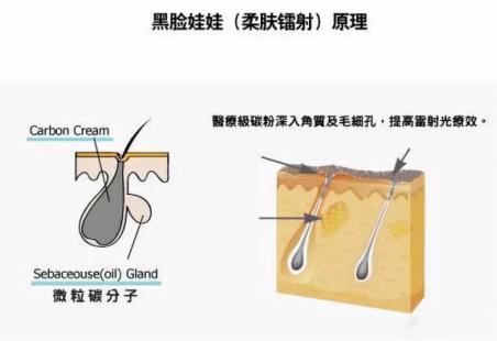 北京伊美爾紫竹醫院：光子嫩膚多久做一次