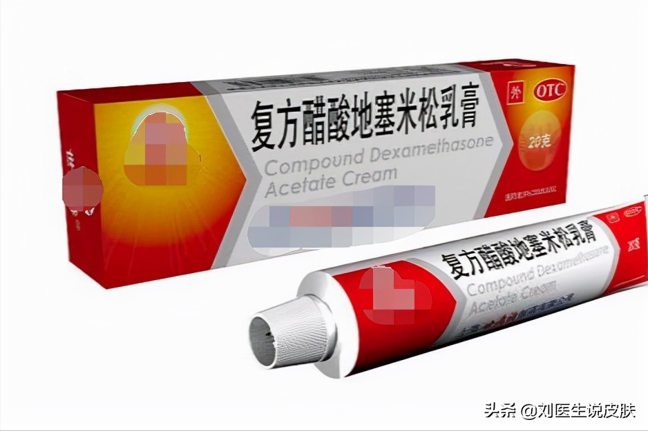 臉上起癬還癢癢怎么辦 臉上長癬怎么辦