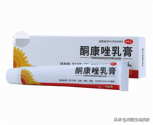 臉上起癬還癢癢怎么辦 臉上長癬怎么辦