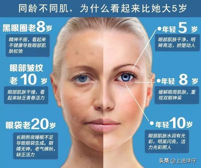 如何去除细纹和皱纹 怎么去细纹